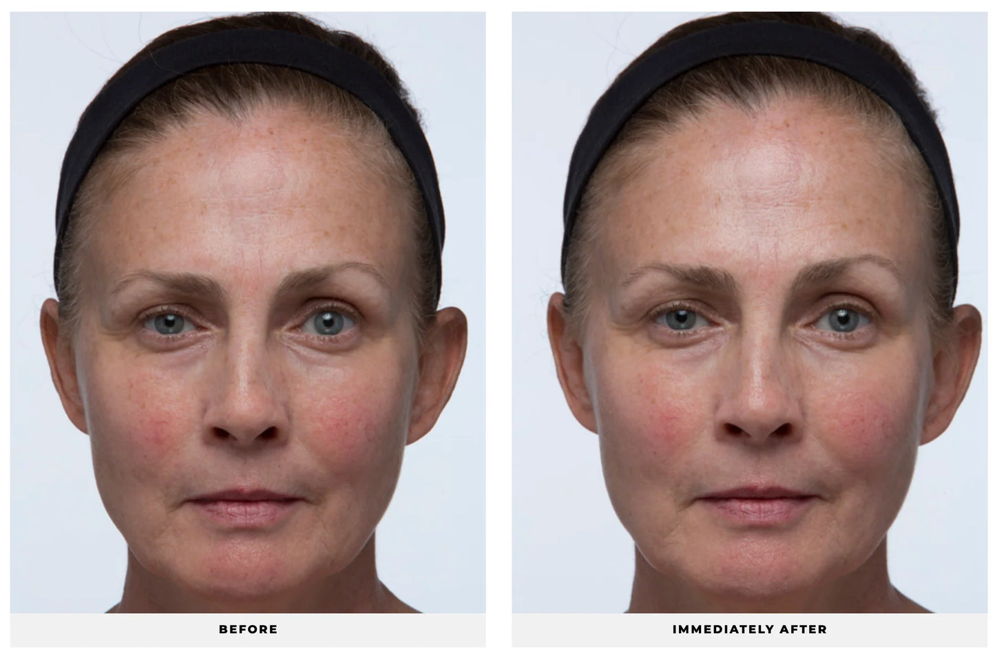 THE DAILY DEFENSE SPF 40