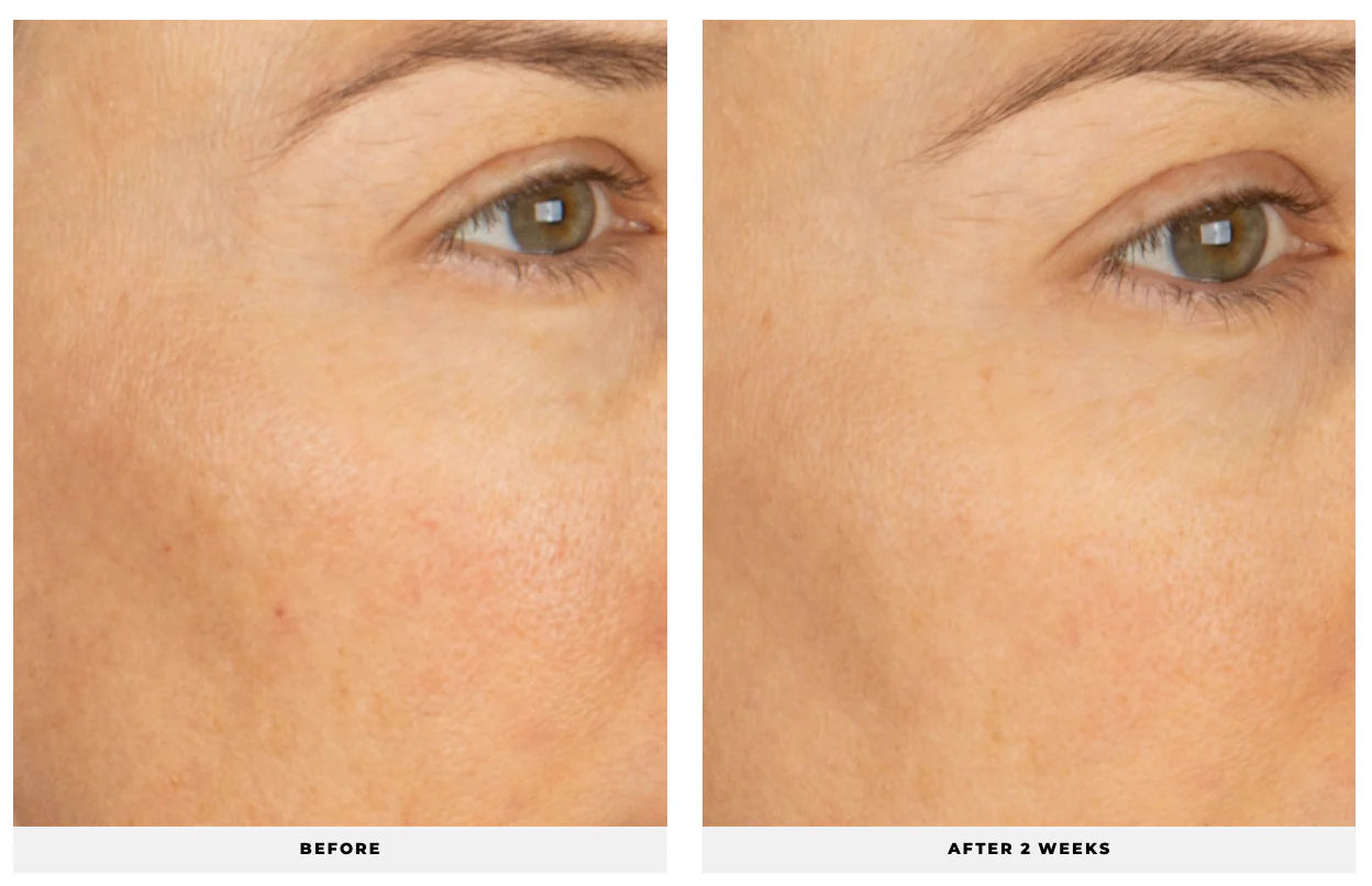 Soothe + Glow Drops